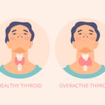 Thyroid Disorders and Weight Loss: Can You Lose Weight with Hypothyroidism?